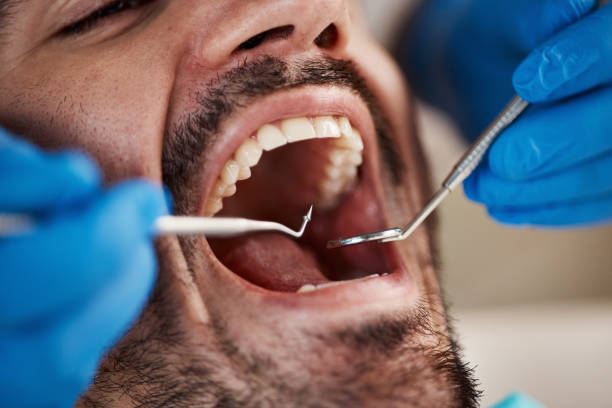 Best Root Canal Treatment  in Church Hill, MD